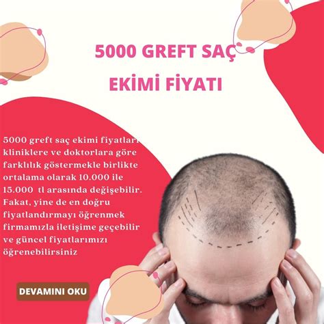 1000 greft saç ekimi fiyatı